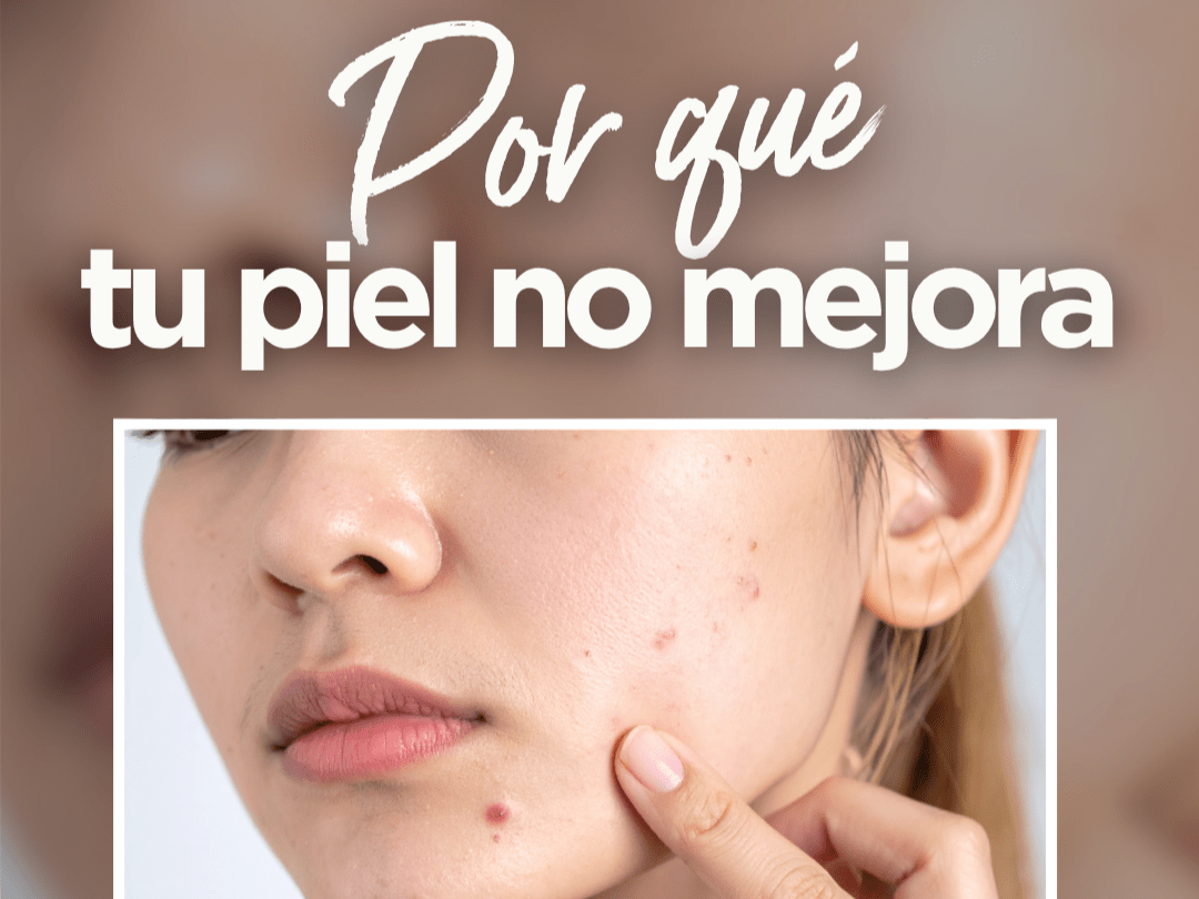 Por Qué Tu Piel No Mejora (Aunque Uses Buenos Productos) - drorganic.es