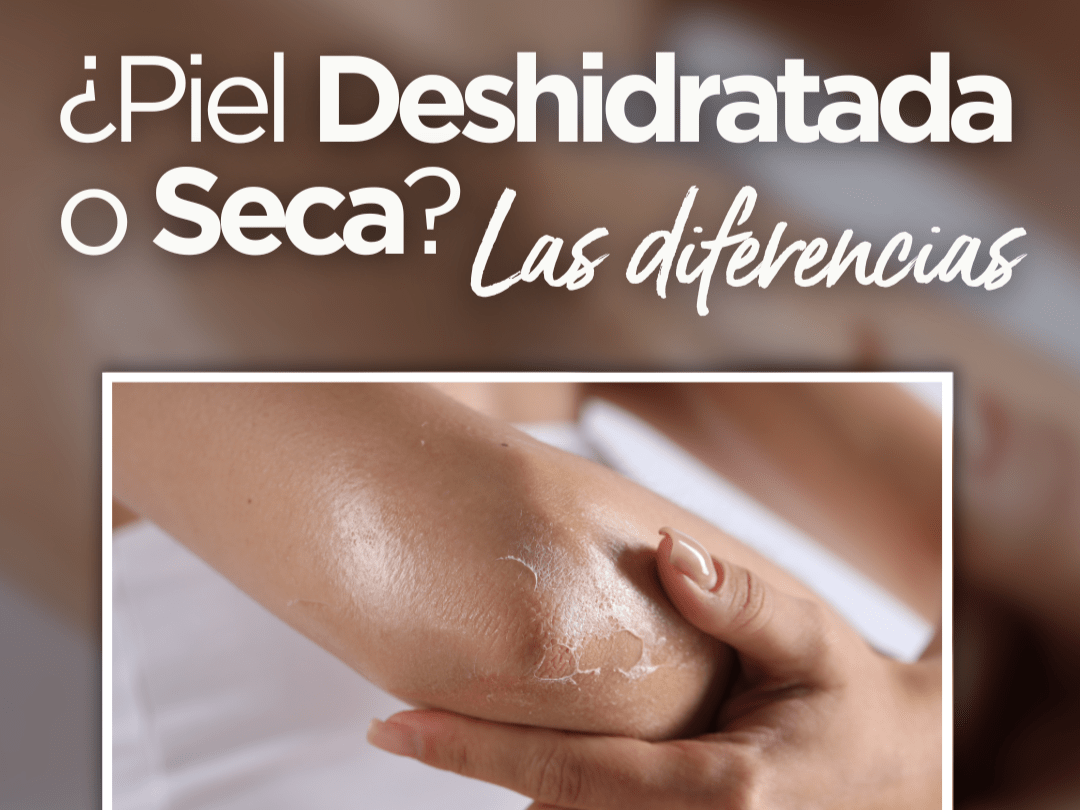 ¿Tu Piel Está Deshidratada o Seca? Aprende a Detectar la Diferencia - drorganic.es