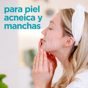 Exfoliante Facial Skin clear para piel acneica o manchas 150ml