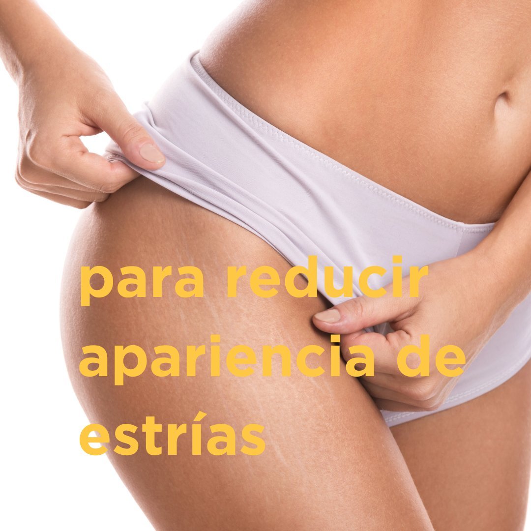 Aceite para estrías 100ml - drorganic.es